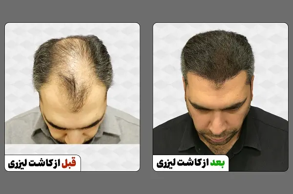 NEW B - A Mashhadi Saraf