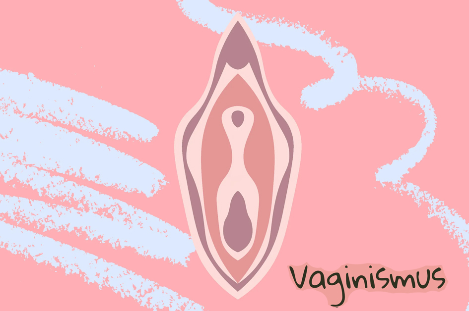 واژینیسموس