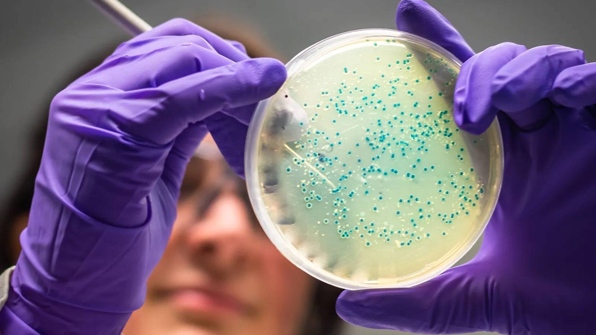 petri-dish-68e77b53a358db02e0901a6e
