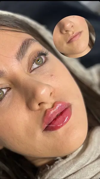 آرتا - ژل لب (3)