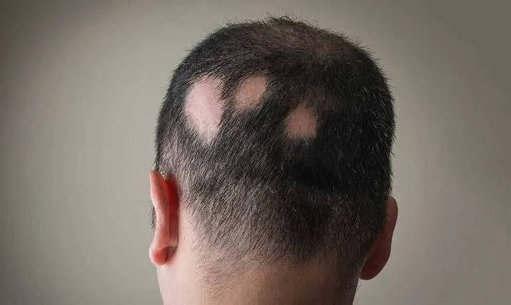 69