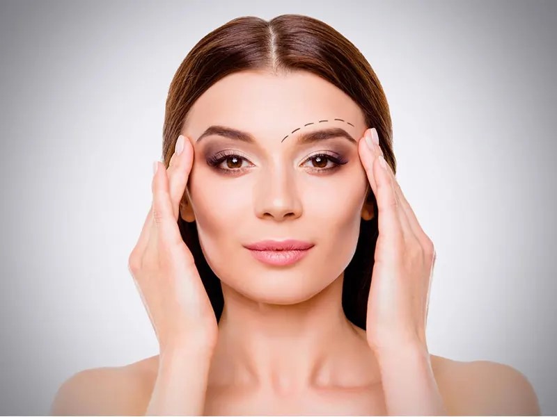 لیفت اندوسکوپی ابرو چه مزایایی به همراه دارد؟