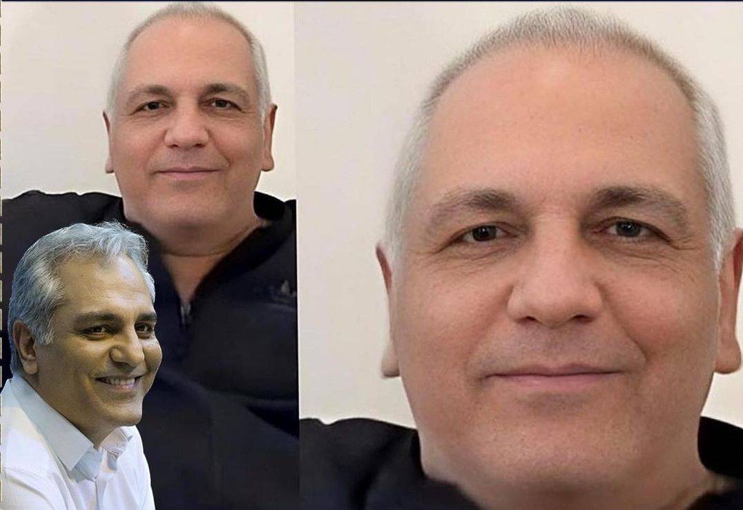 شکستگی چهره مهران مدیری در 56 سالگی همه را شوکه کرد!