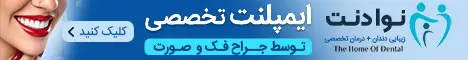 نوادنت - رندوم