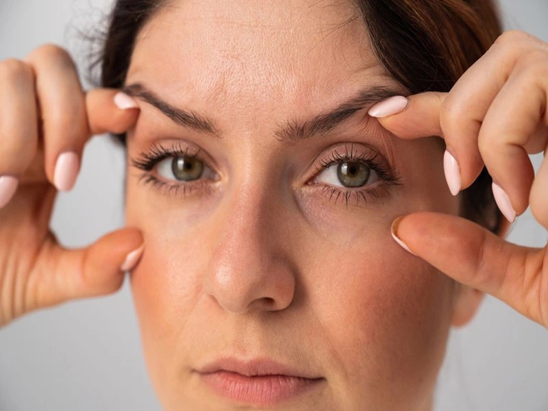 برای عمل ترمیم بلفاروپلاستی به چه دکتری مراجعه کنیم؟