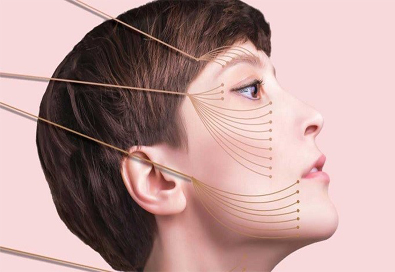 لیفتینگ صورت