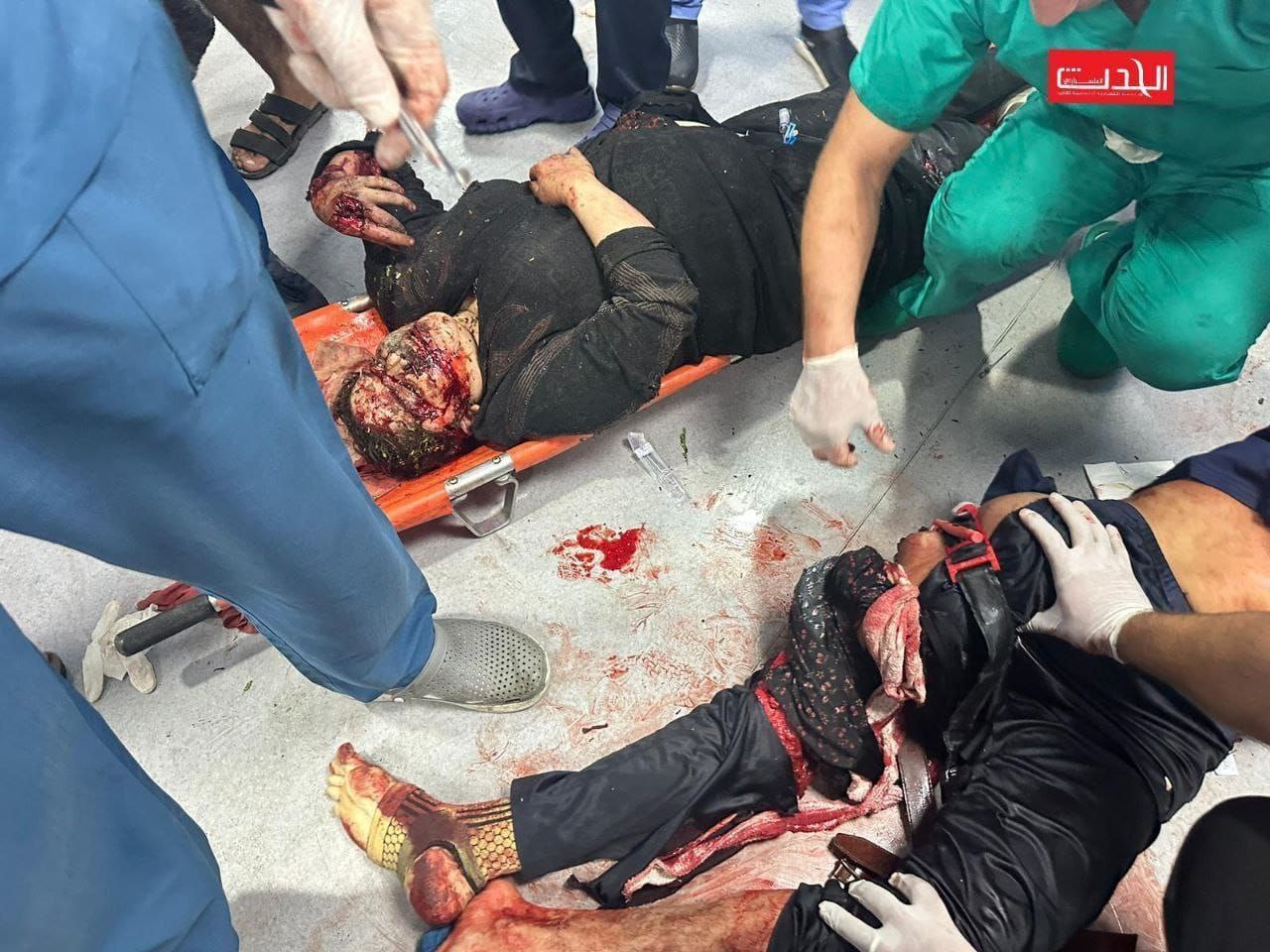 تصاویر دردناک و دلخراش از حمله به بیمارستان غزه