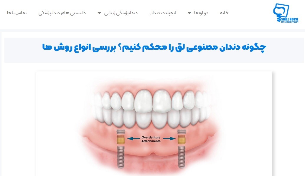 برای جا افتادن دندان مصنوعی چه کنیم؟ معرفی 3 روش کاربردی 