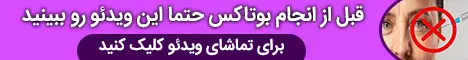 5040 - استیکی پایین