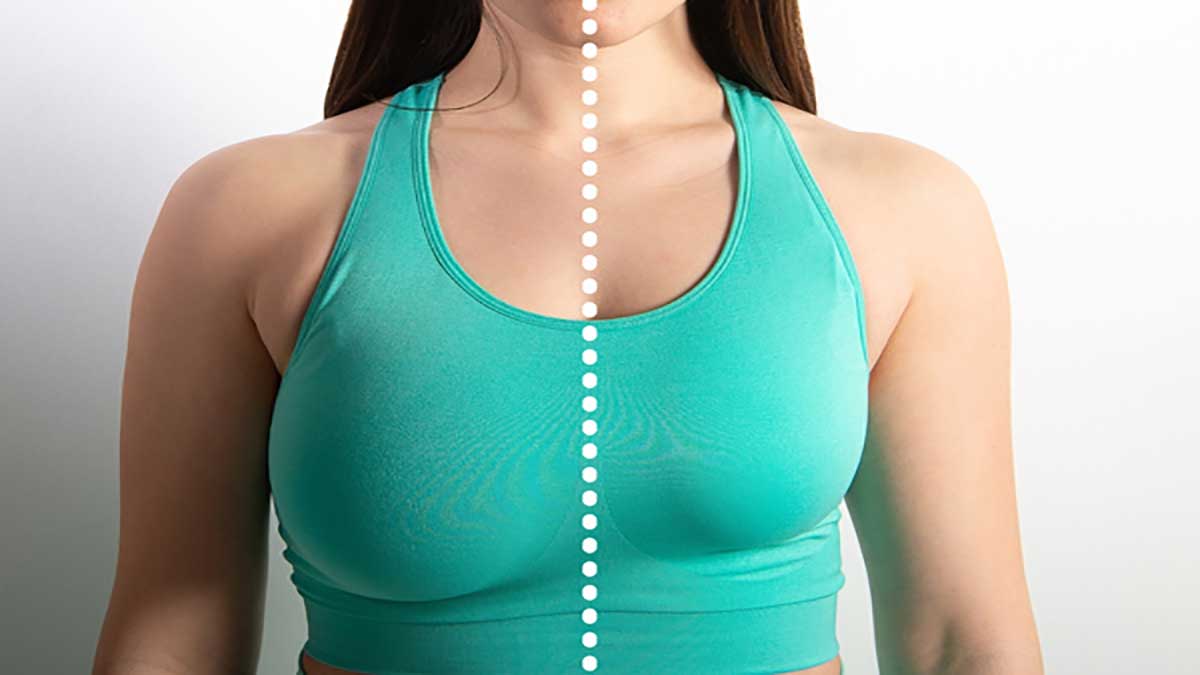 mammoplasty-after-before