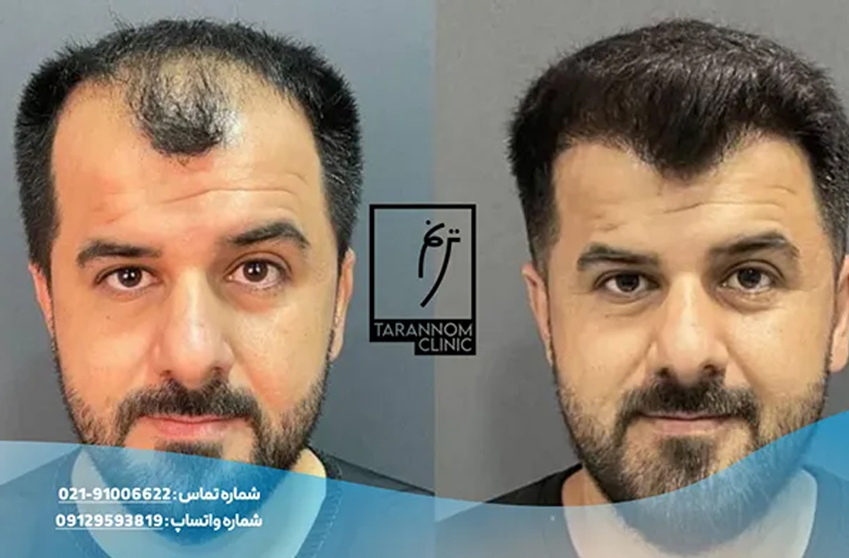 ویژگی های کلینیک کاشت مو