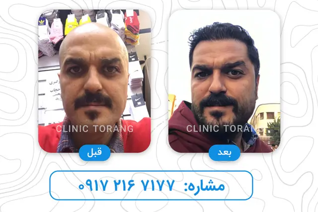 shirazkasht-before-after(1)