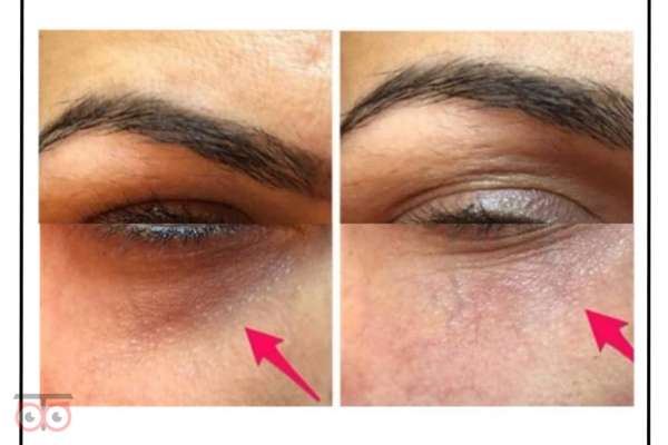 تخفیف-ویژه-خدمات-زیبایی-کلینیک-دریتا