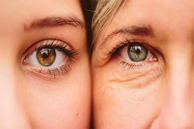 کاهش چین‌وچروک های زیر چشم