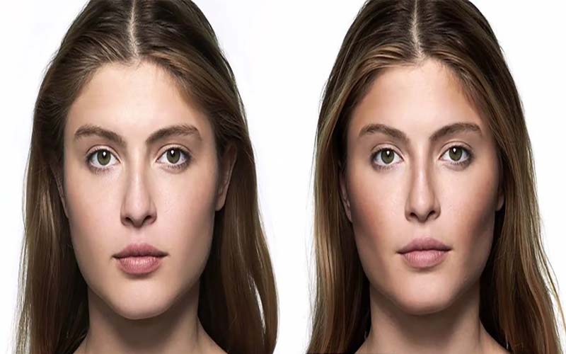افراد متقاضی زاویه سازی صورت