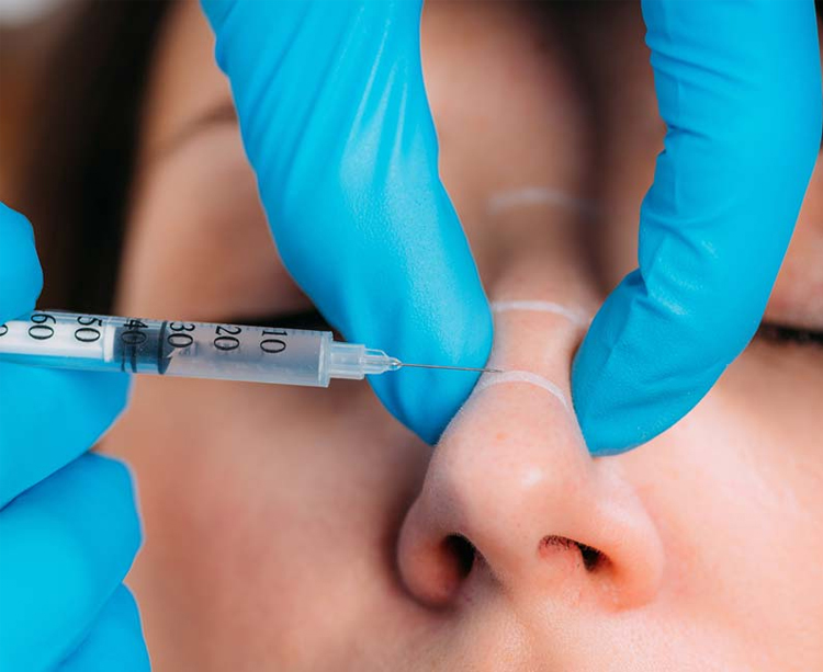 ویژگی های بهترین دکتر فیلر بینی