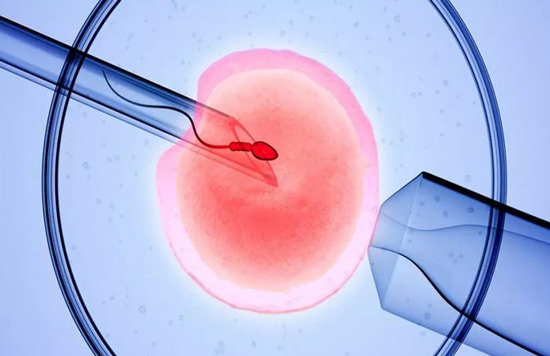 بچه دار شدن با IVF چگونه انجام می شود؟