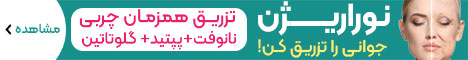 ثنایی_استیکی رندوم