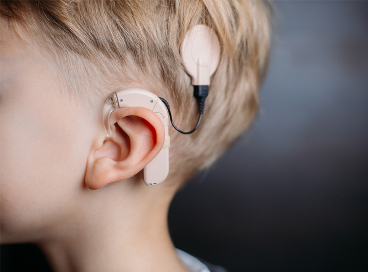 قبل از خرید انواع سمعک به چه عواملی باید توجه کنیم؟