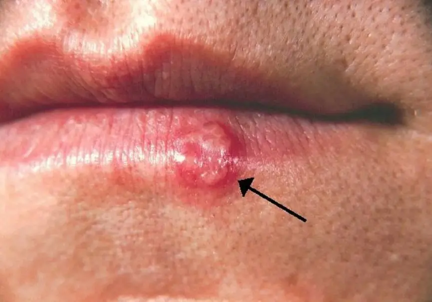 44c4c173