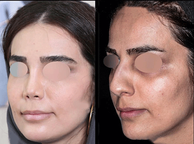 nody-عکس-دکتر-شهریار-یحیوی-1720832114
