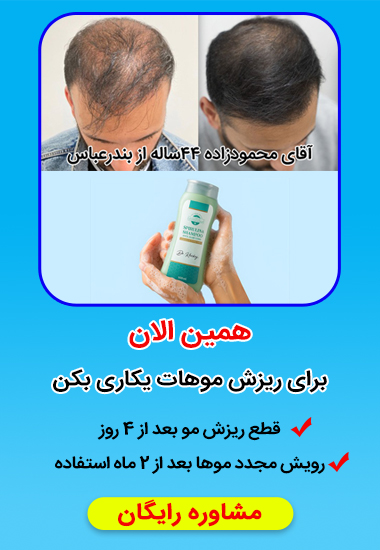 بنر موبایل