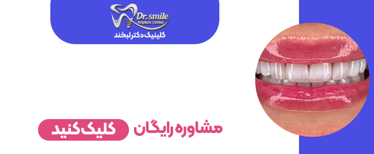 دکتر لبخند - بنر فوتر