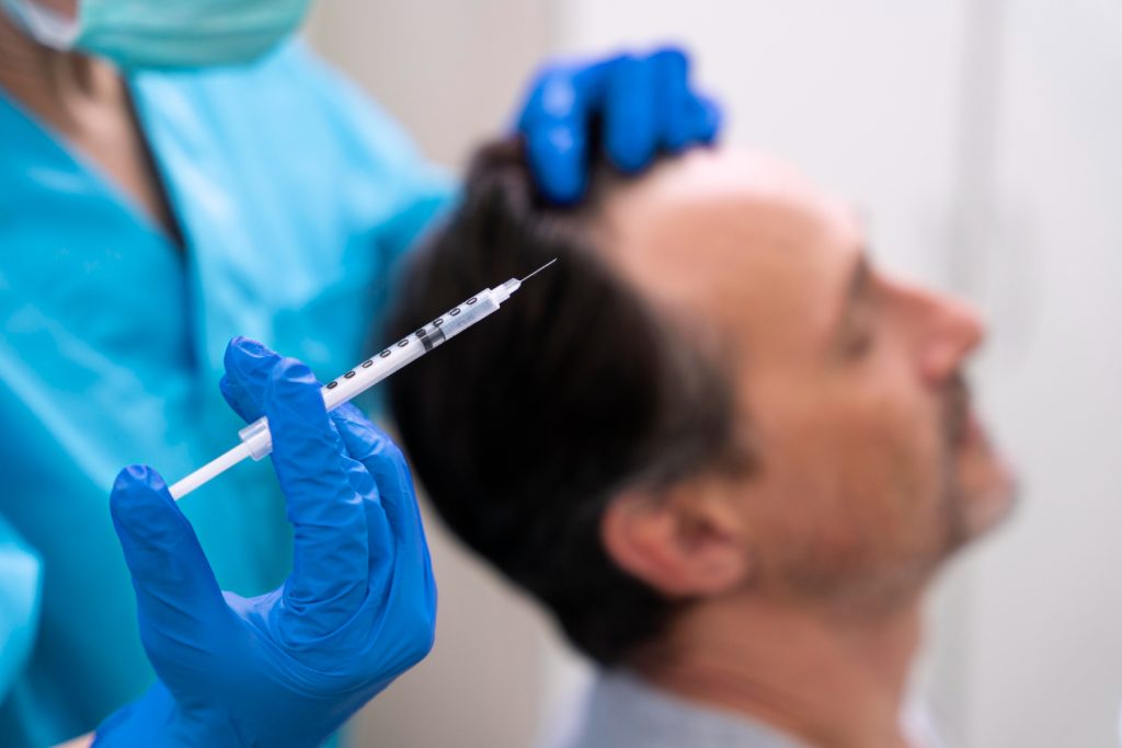 مزایای پلاسمای غنی از پلاکت (PRP)