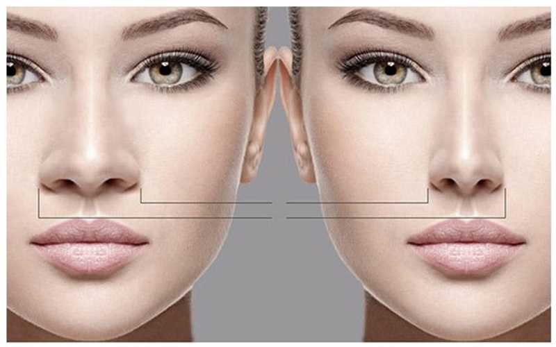 بهترین جراح بینی گوشتی چه ویژگی‌هایی دارد؟