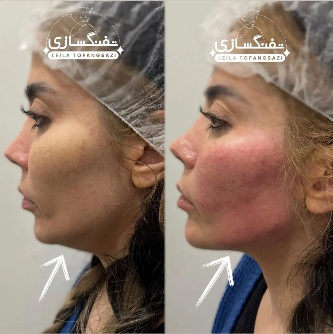 دکتر لیلا تفنگسازی  (2)