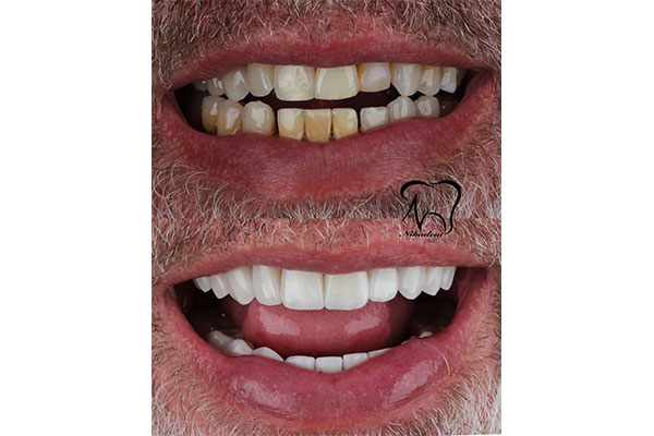 نمونه های خدمات دندانپزشکی نیکا دنت