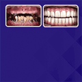 کلینیک دندانپزشکی ایثار_شناور