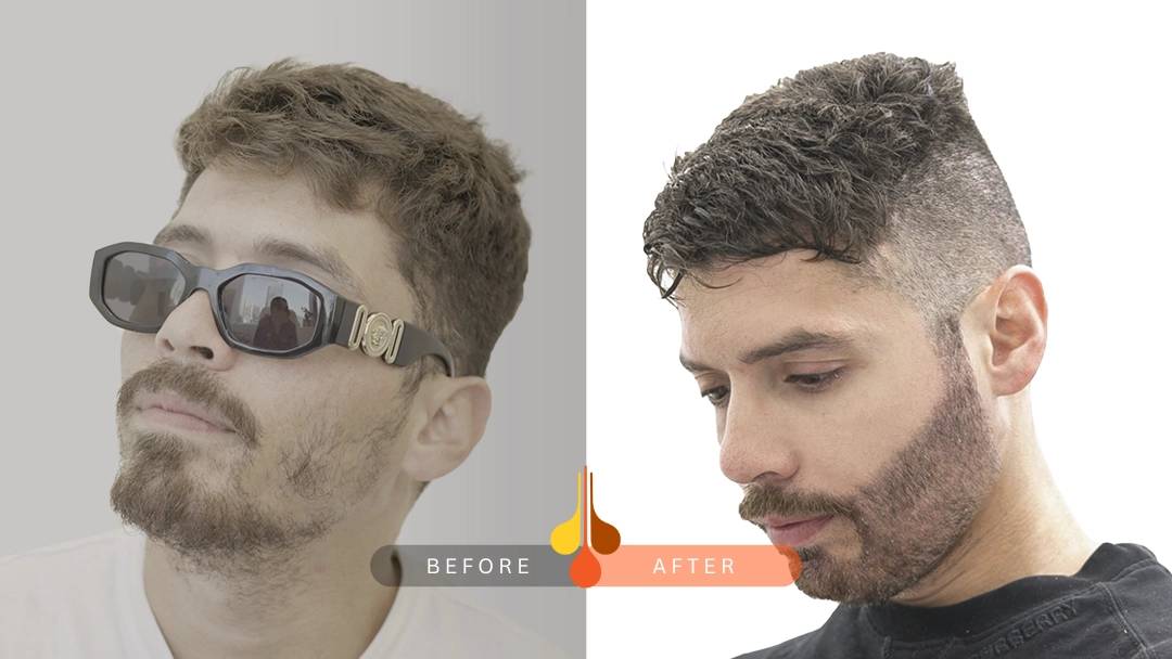 BEFORE-ria1-1.webp