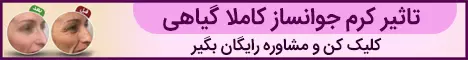 5040 - استیکی پایین
