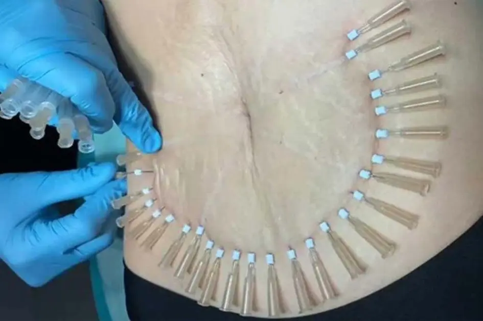 نحوه انجام امبدینگ چگونه است؟