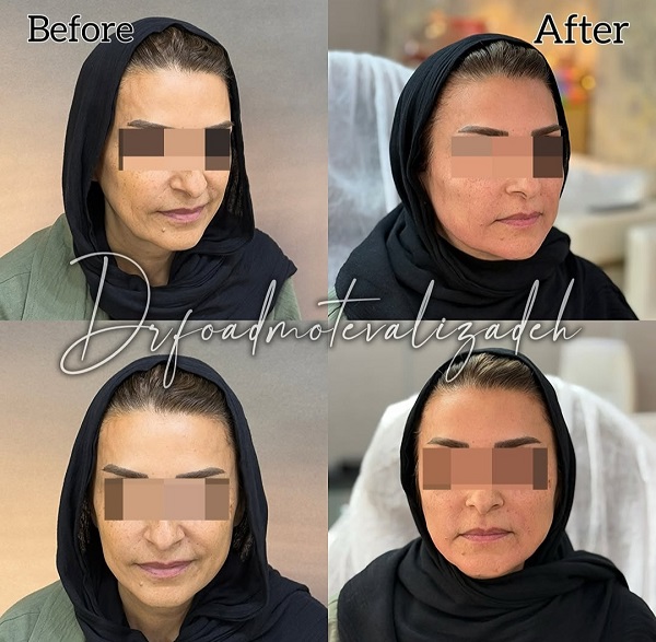 نمونه جوانساز نسل 4 دکتر فواد متولی زاده