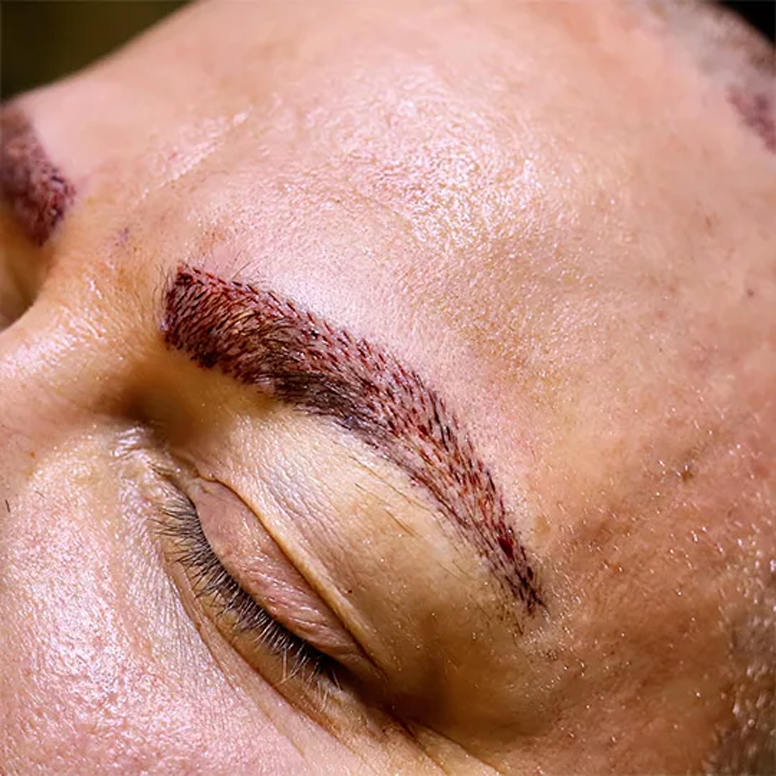 روش های کاشت ابرو