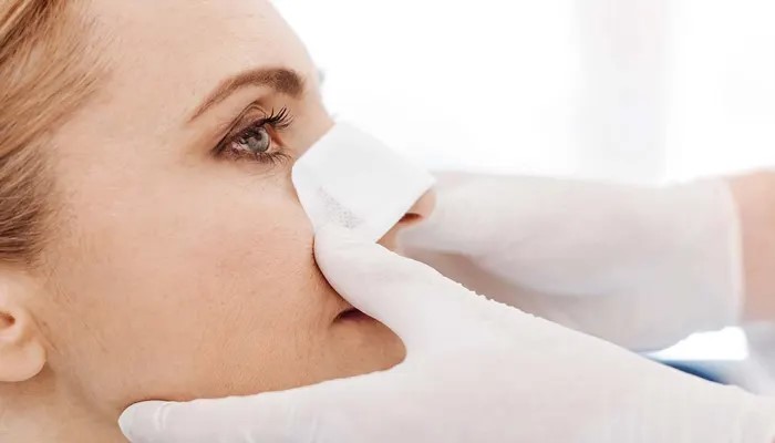 تمرین های تنفسی بعد از اصلاح فرم بینی بدون جراحی