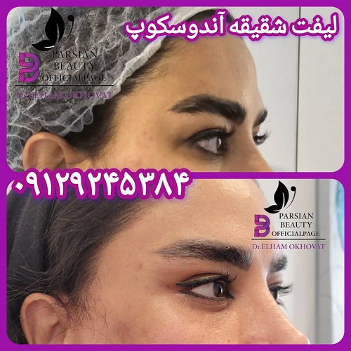 کلینیک زیبایی پارسیان ظفر