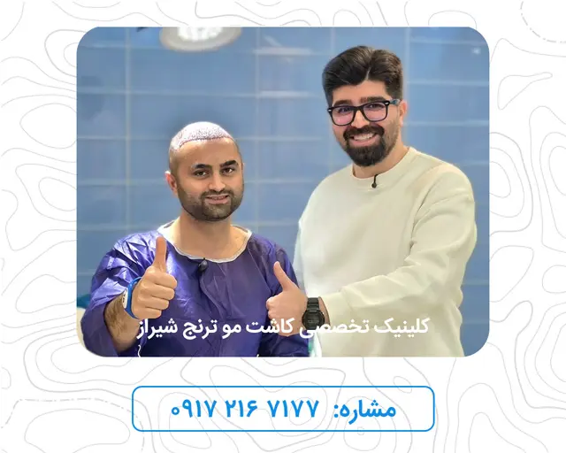 hair-transplantation-shiraz