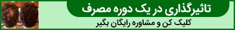 5040 - استیکی پایین