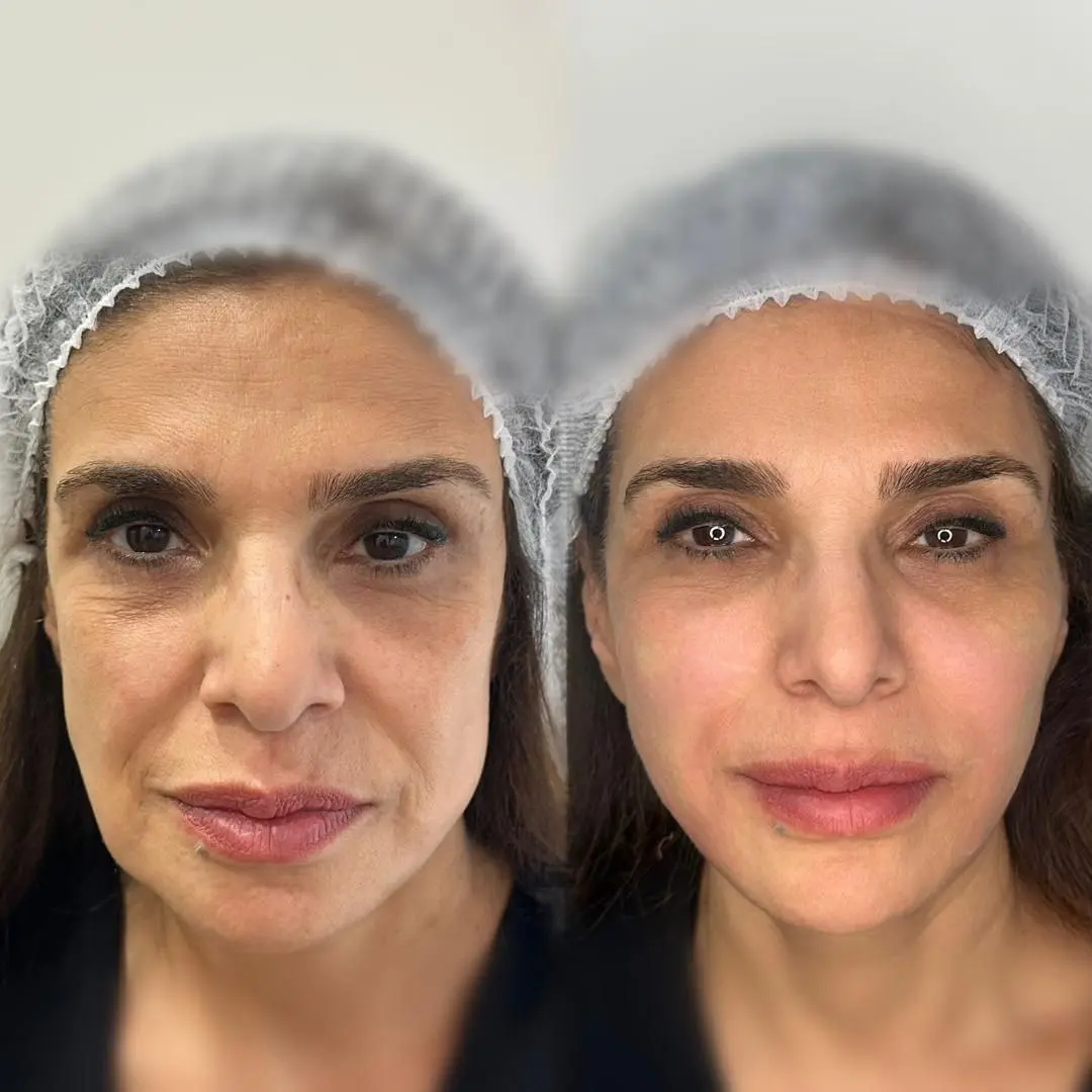 دکتر لیلا تفنگسازی  (1)