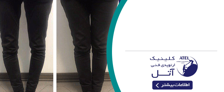 فوتر داخلی_فنی آتل
