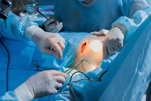 breast-implant-mashhad-9