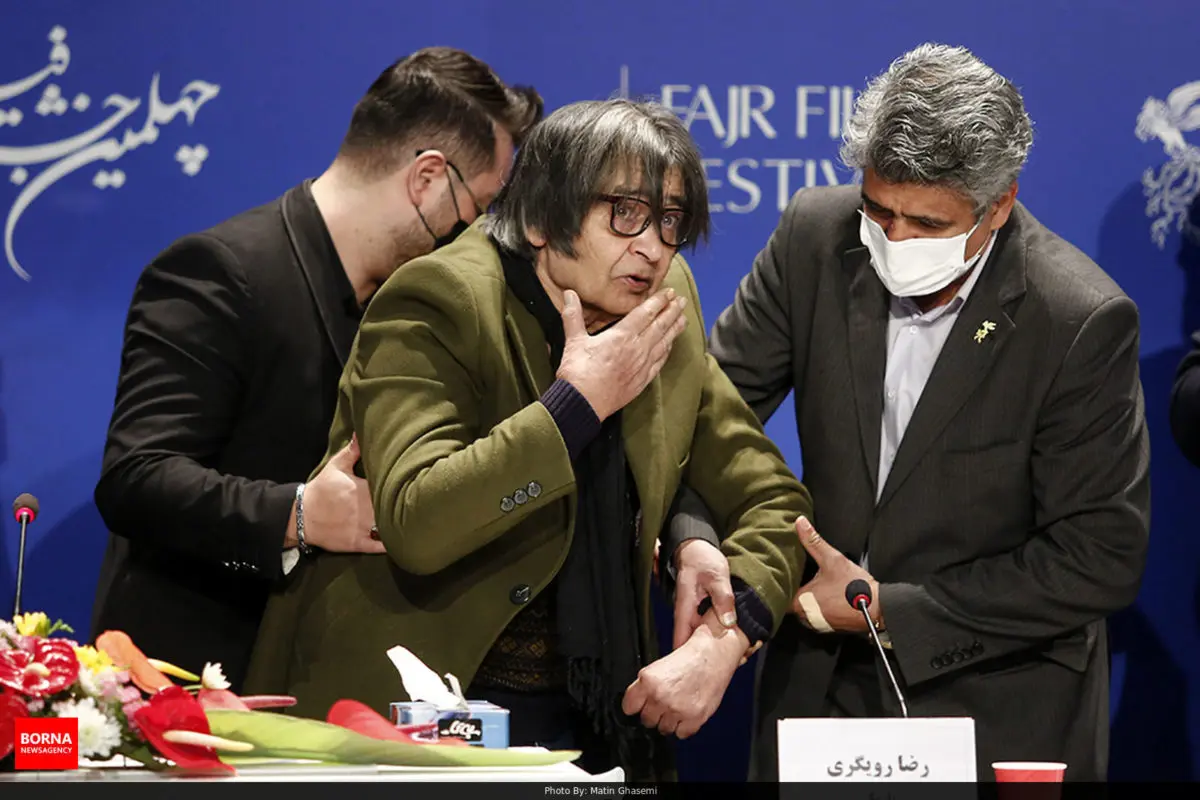 رضارویگری-1-e1651396267819