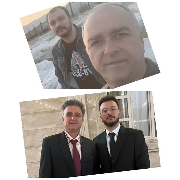 نمونه کاشت مو در کلینیک آرتان