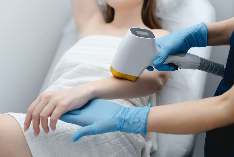 لیزر موهای زائد چه مزایایی دارد؟