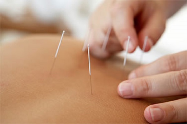 acupuncture-for-lifting-hip2