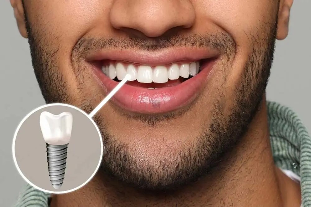 آیا ایمپلنت لیزری باعث عفونت می‌شود؟