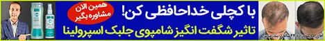 5040 - رندوم افر شامپو
